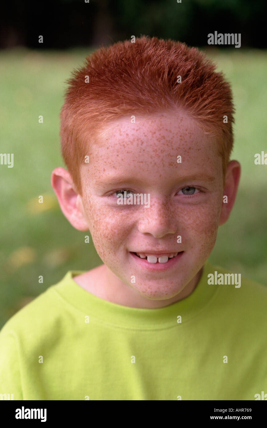 freckle boy 
