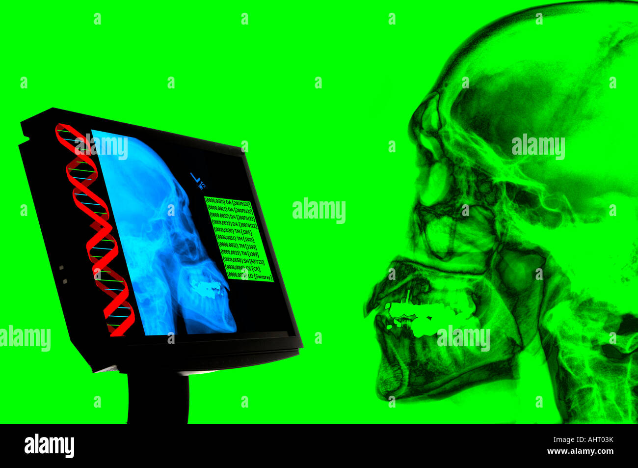 digital x-ray human skull computer monitor Stock Photo - Alamy