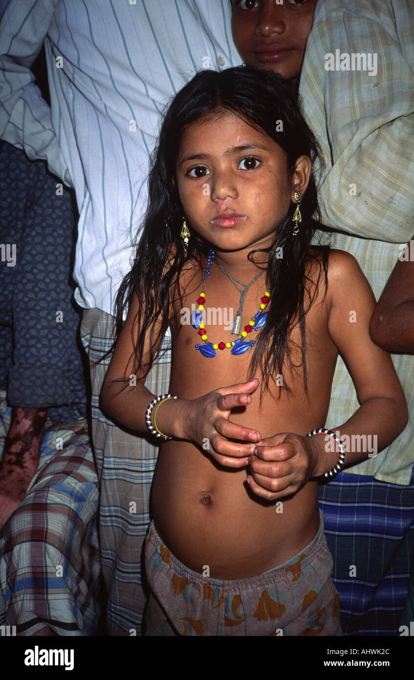 Young homeless girl living on the streets. Dhaka, Bangladesh Stock Photo