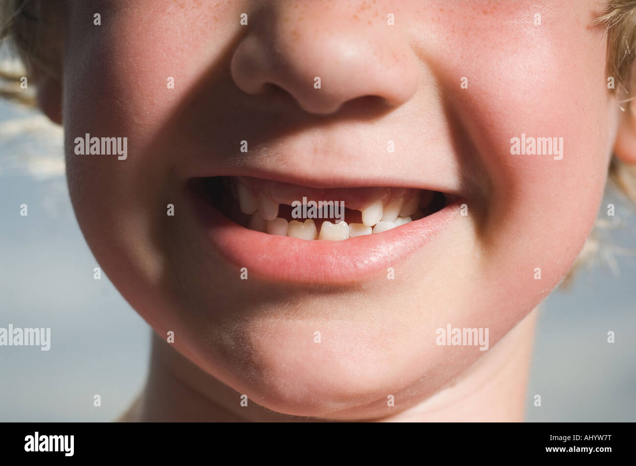 Boy with missing teeth smiling Stock Photo