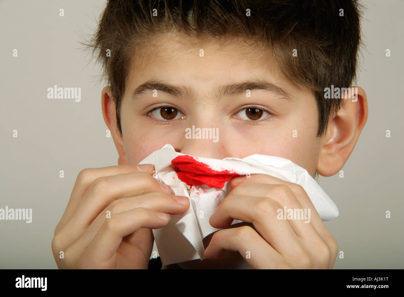 portrait of a young boy with a nosebleed Stock Photo