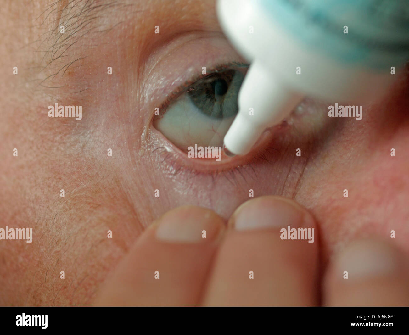 putting eye drops in eye part of face Stock Photo Alamy