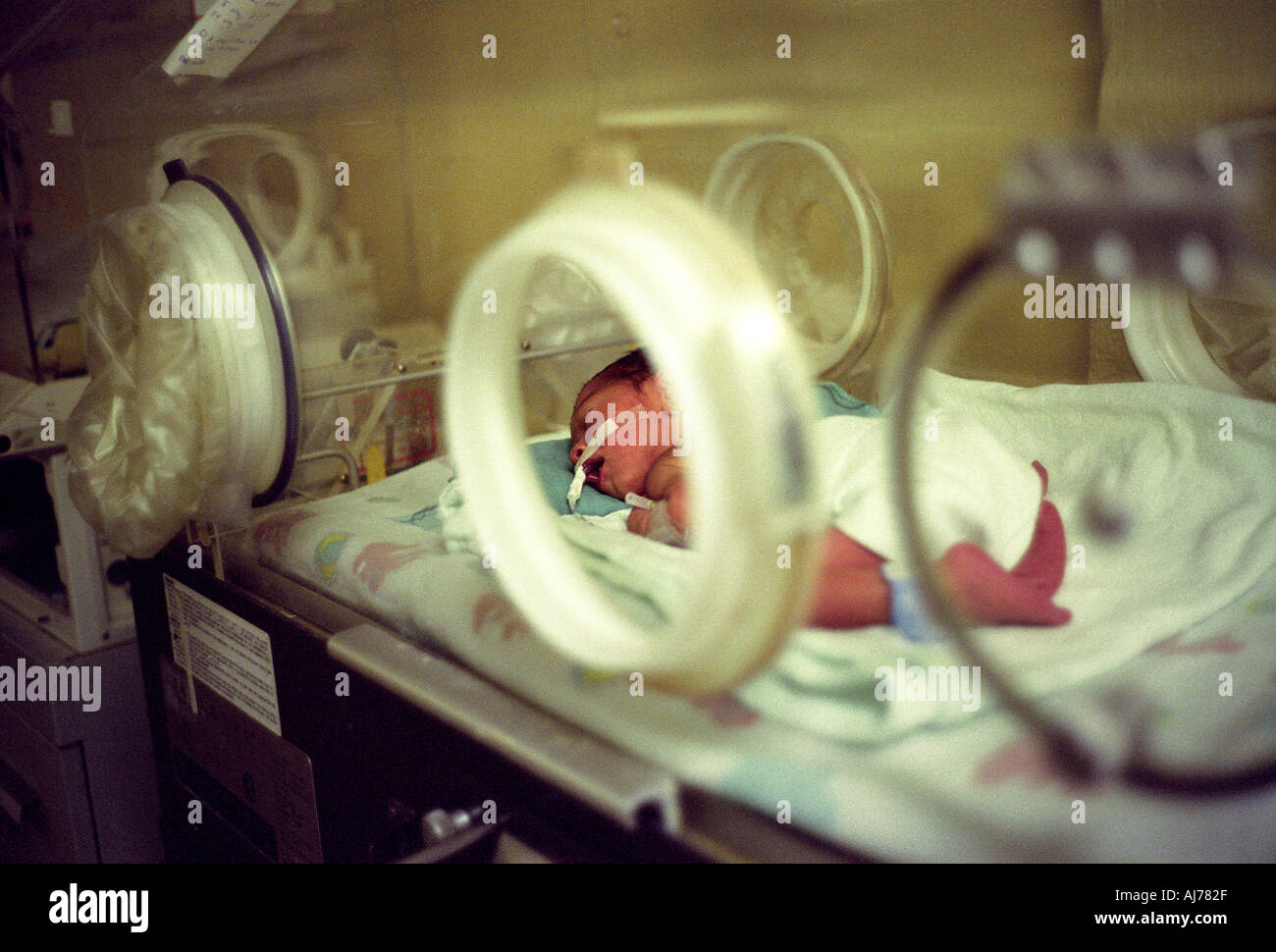 premature baby in the Hospital Cesar A Molina nicaragua Matagalpa Stock Photo