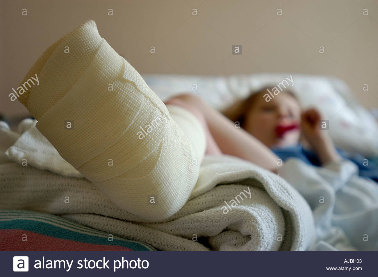 Child Broken Leg Plaster Stock Photos & Child Broken Leg Plaster Stock Images Page 2 Alamy