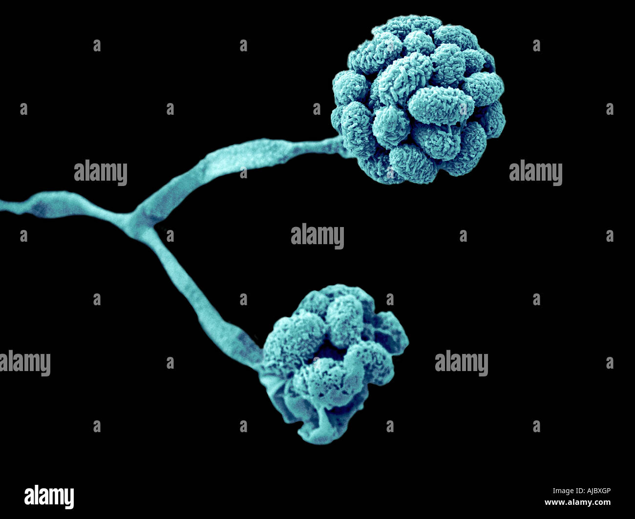 A scanning electron micrograph (SEM) of Stachybotrys chartarum Stock Photo