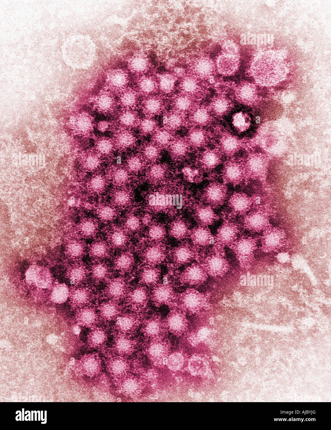 A transmission electron micrograph (TEM) showing numerous hepatitis virions, of an unknown strain. Stock Photo