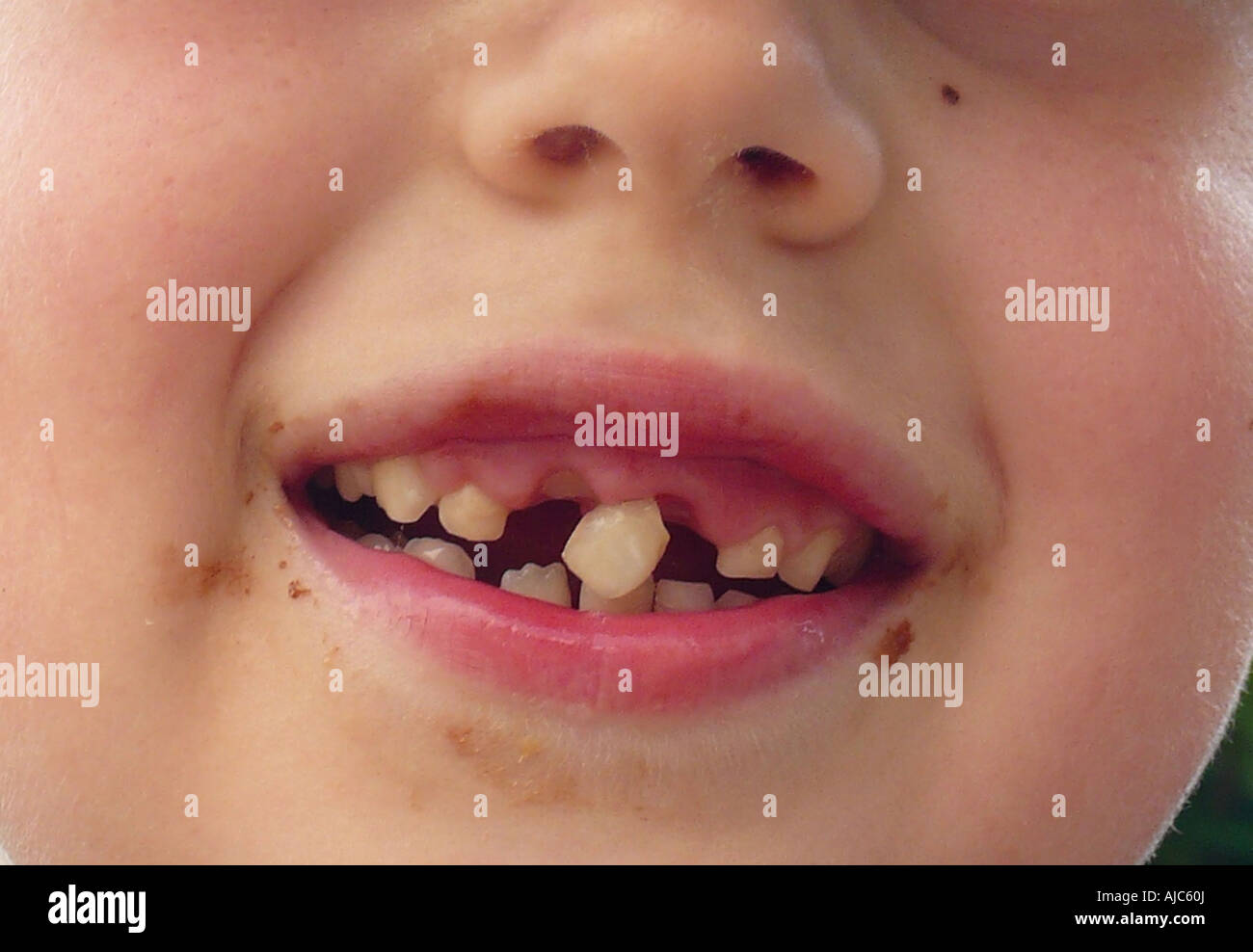 Wobbly tooth hires stock photography and images Alamy