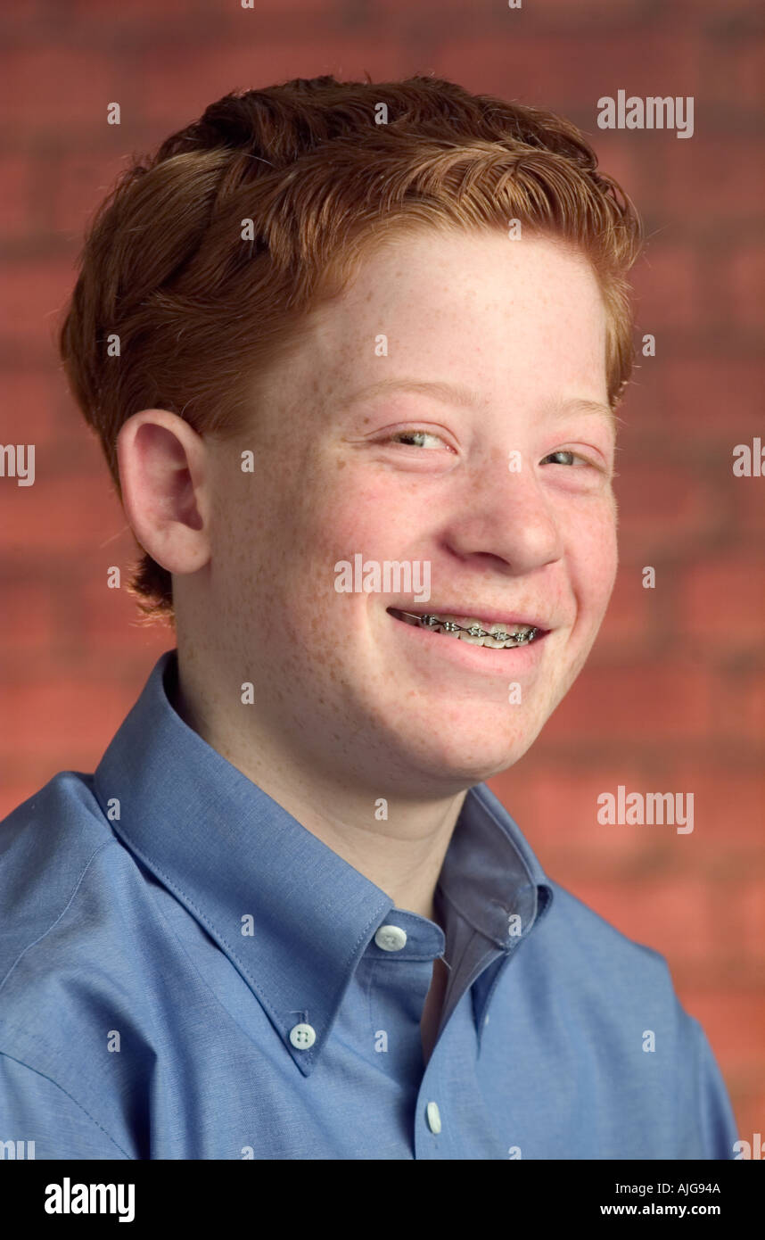 Redheads With Braces