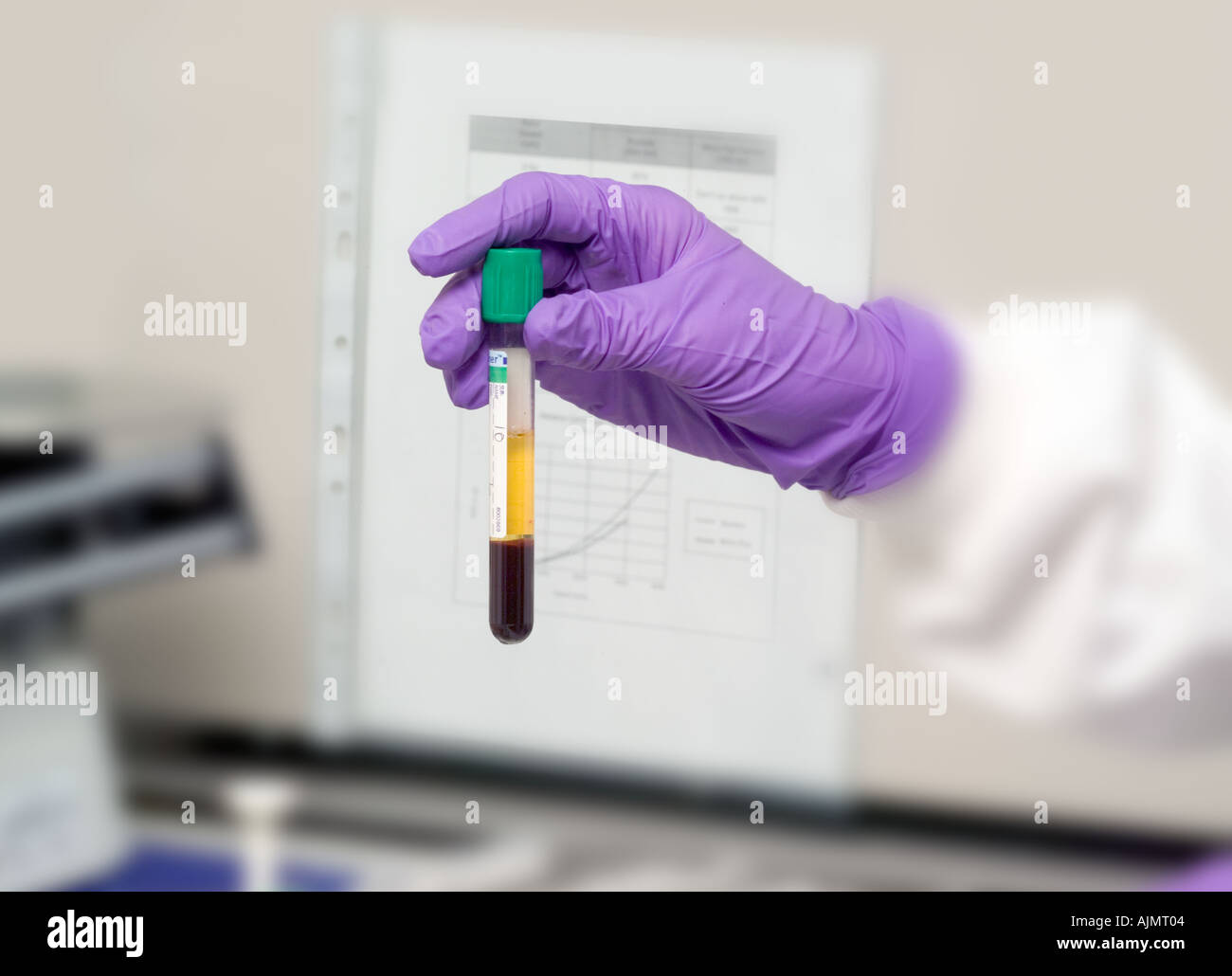 Centrifuged sample of human blood in tube Stock Photo Alamy