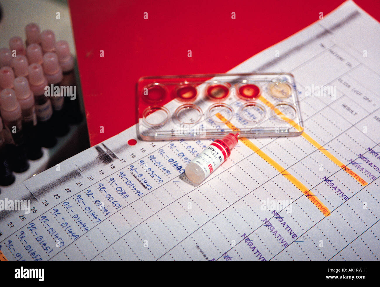 Hiv test kit hires stock photography and images Alamy