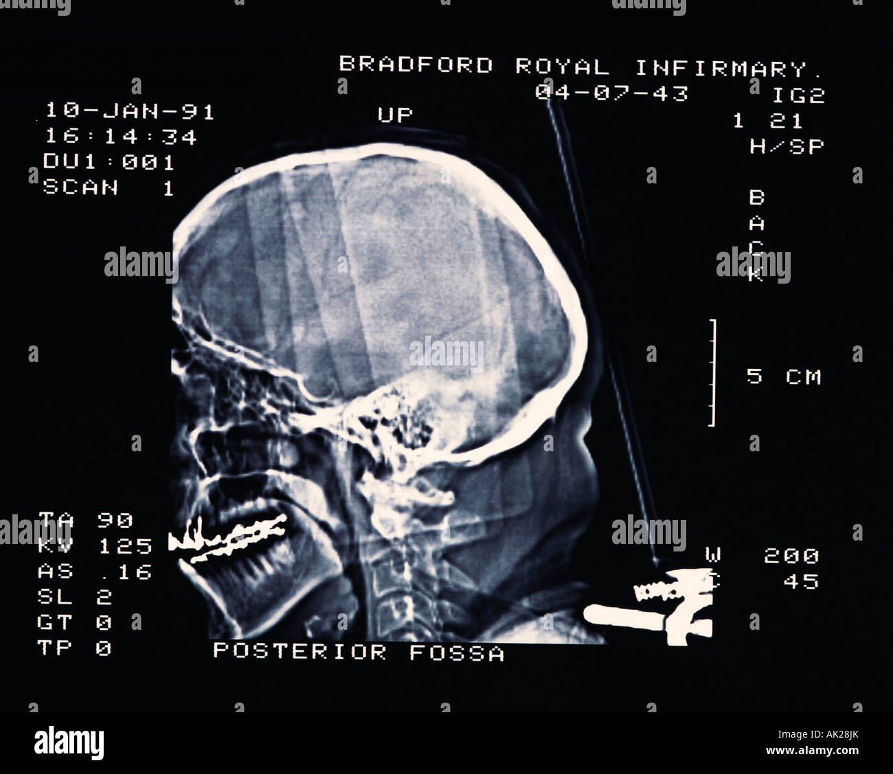 Medical & pharmaceutical, X-Ray of human head, Stock Photo