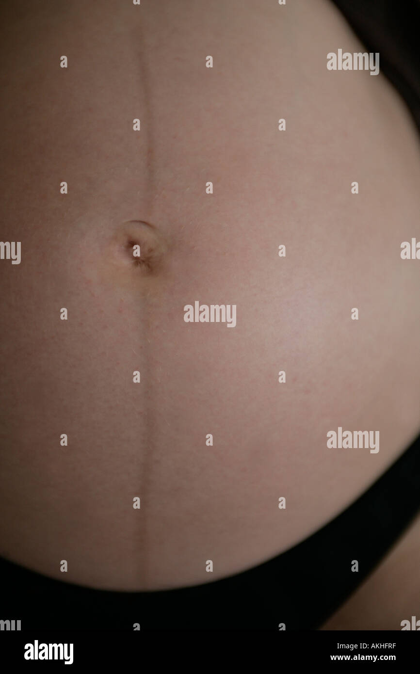 linea nigra on a pregnant woman Stock Photo