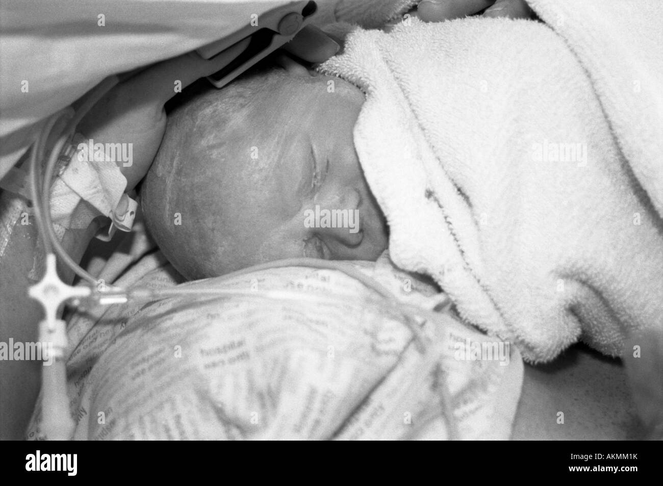 Baby boy after being delivered by caesarian section, approx 3 hours old Stock Photo
