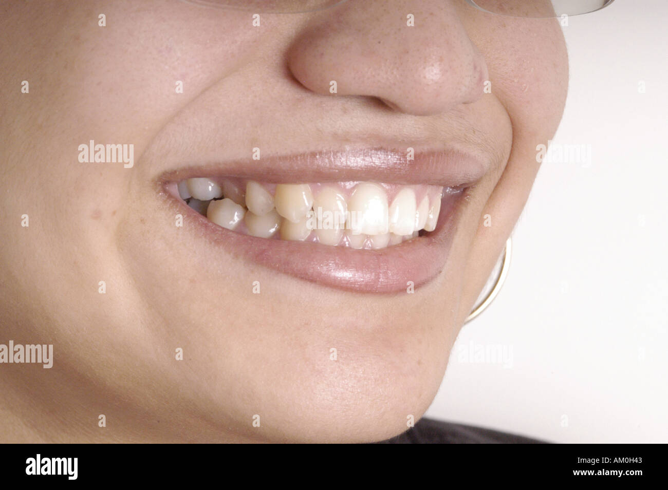 smile teeth lips mouth dental dentist orthodontic maxillo facial face