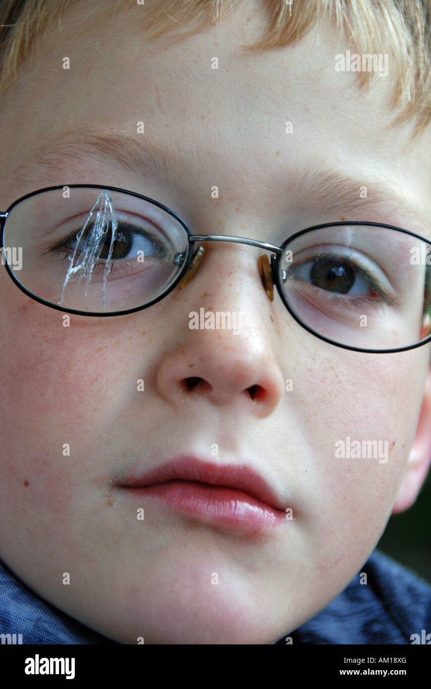 Boy with broken glasses Stock Photo