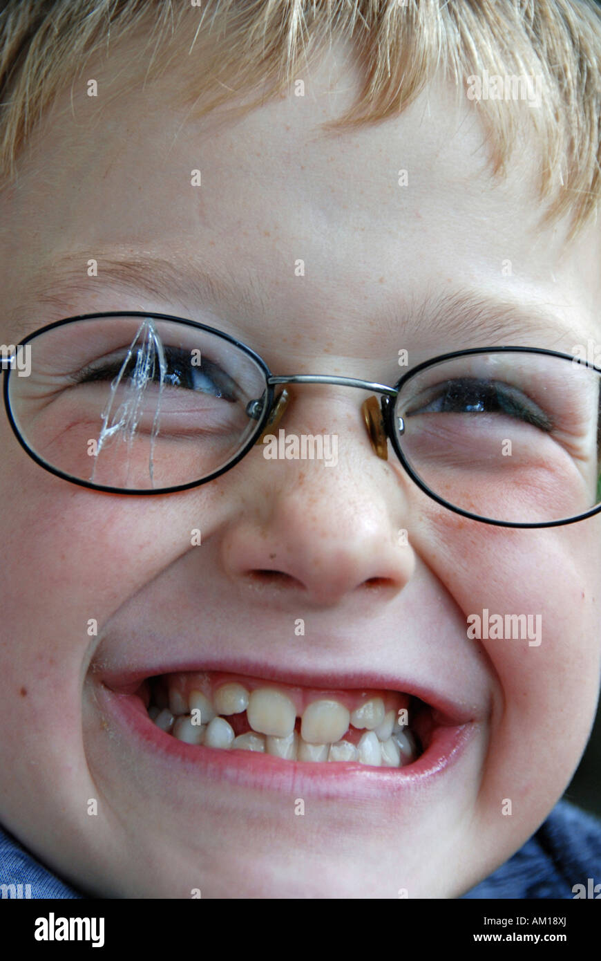 Boy with broken glasses Stock Photo