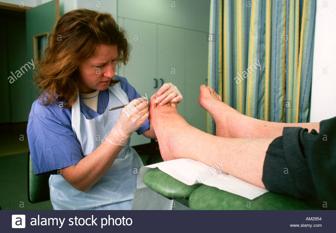 Diabetic Foot Stock Photos & Diabetic Foot Stock Images Alamy