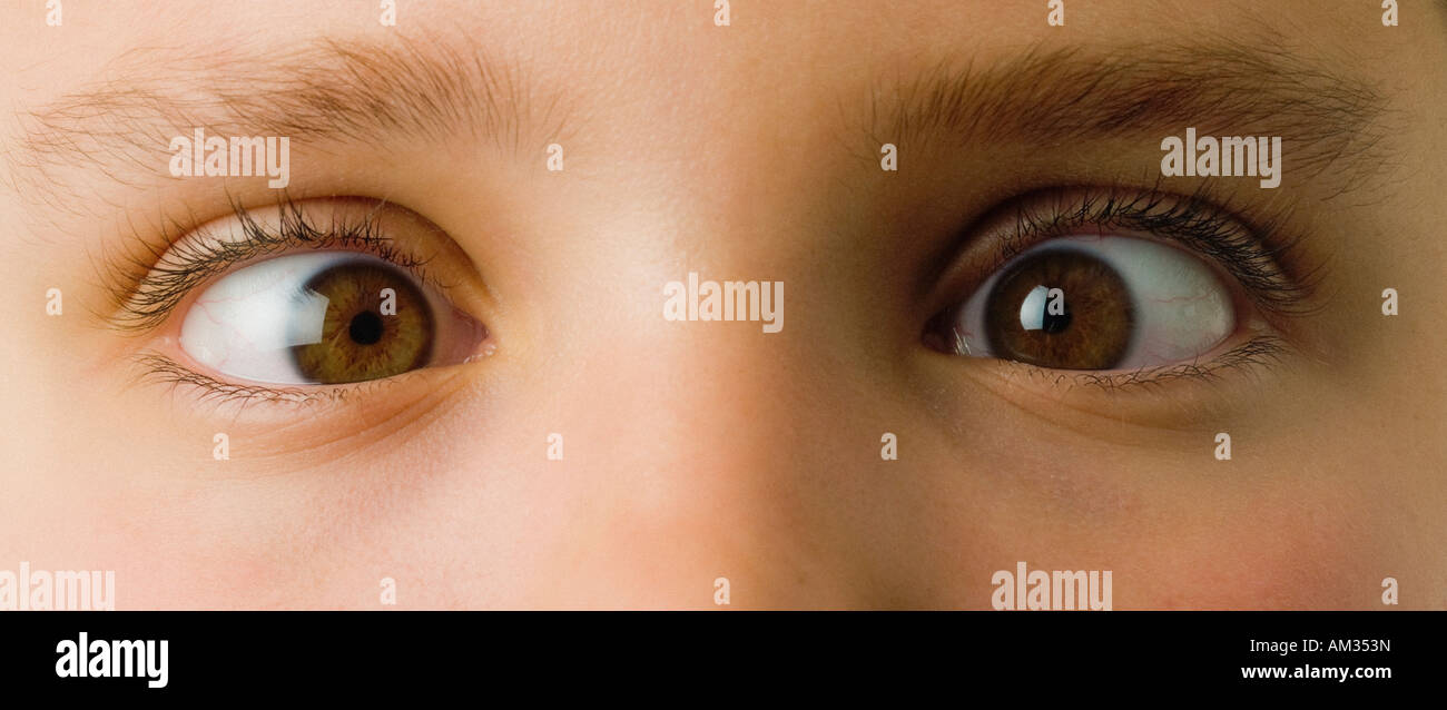 Eyes: close-up of a young Caucasian person with brown crossed eyes. Stock Photo