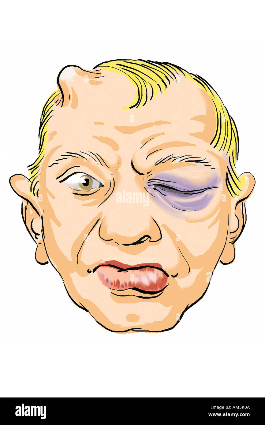 Beule cartoon hi-res stock photography and images - Alamy