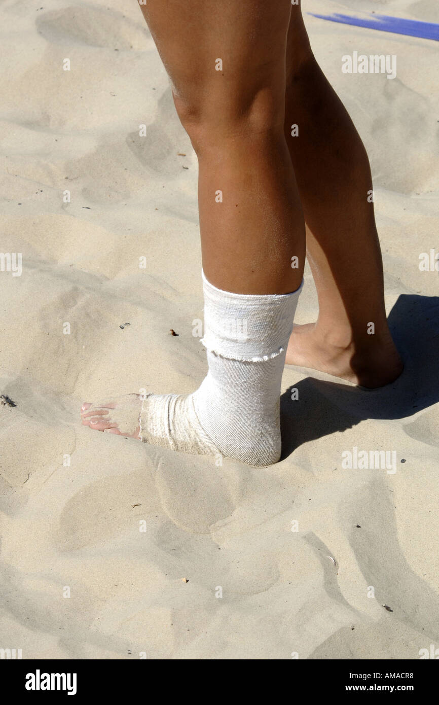 Adult female has a bandaged sprained ankle taking part in a Volleyball