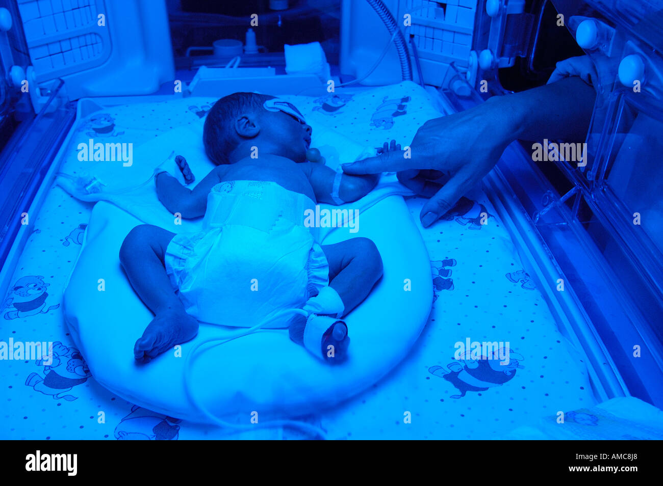 New Born premature  Baby in incubator - Neonatal Intensive Care Unit - NICU Stock Photo