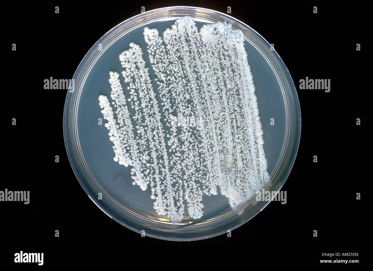 Candida albicans from sputum Stock Photo