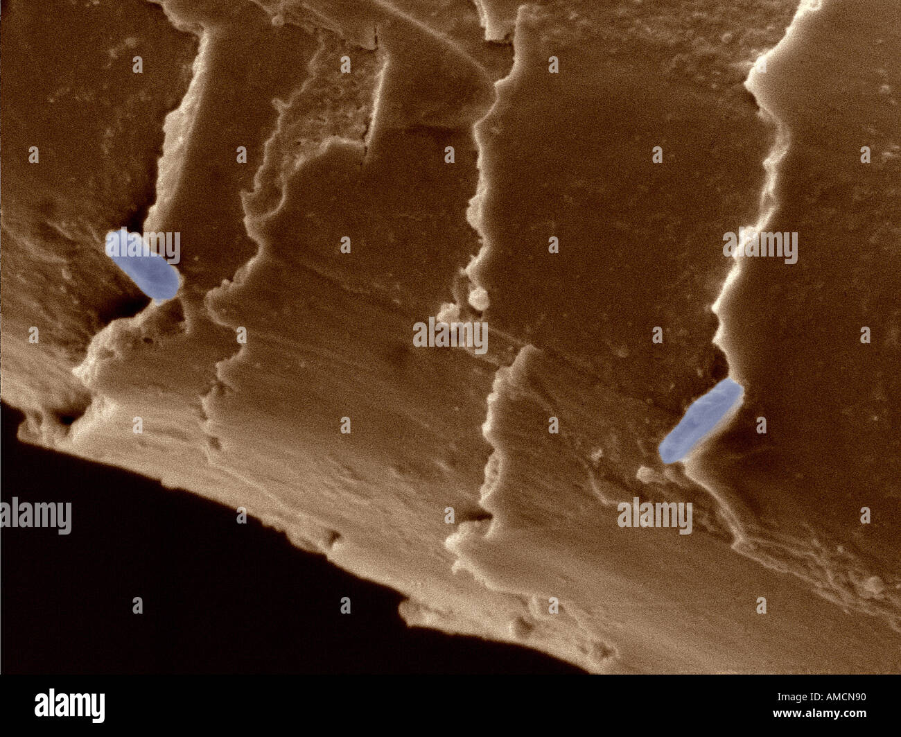 SEM human hair and bacteria Stock Photo Alamy