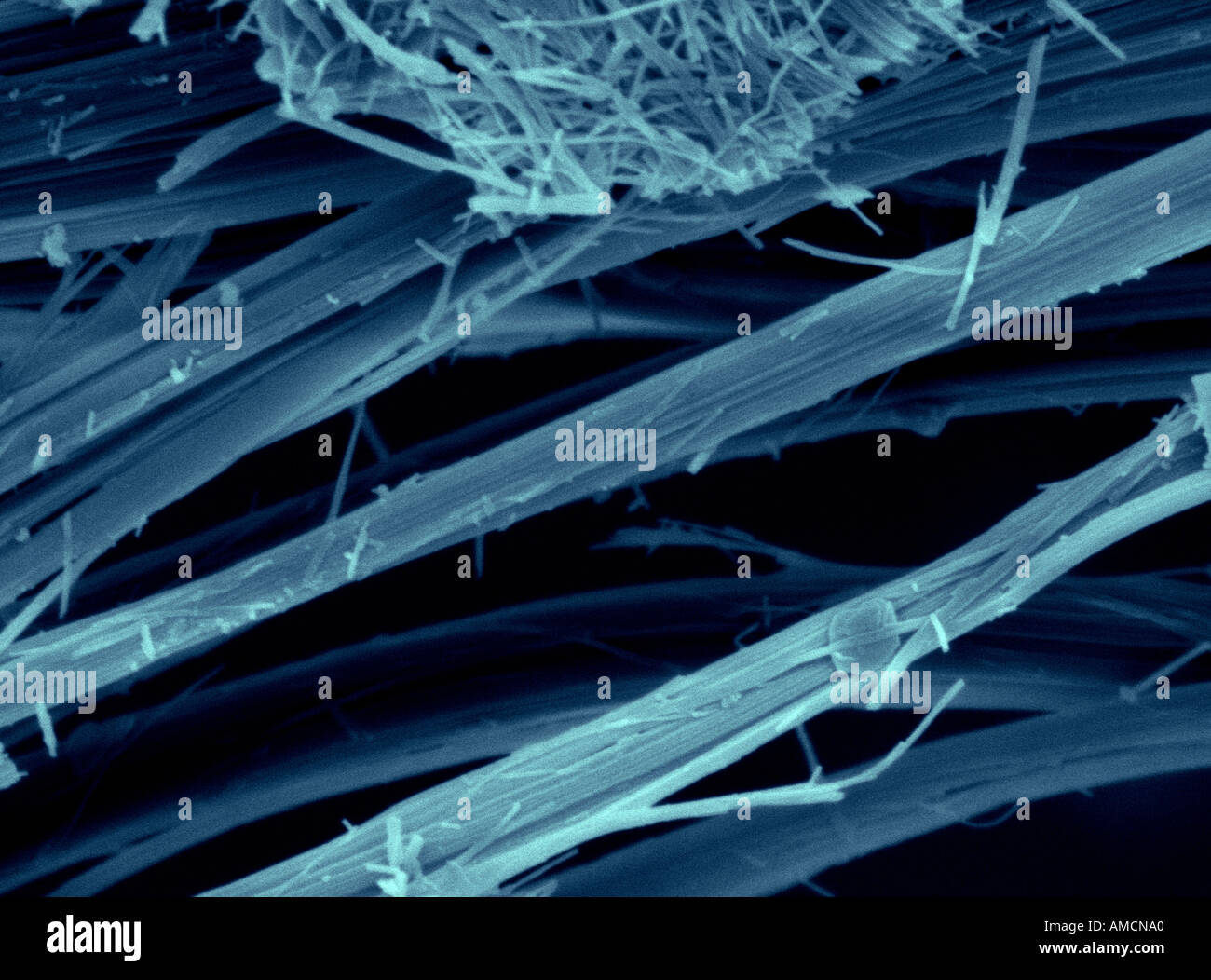 SEM - Asbestos fibres Stock Photo