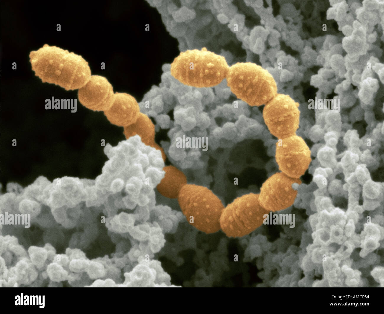 SEM - yoghurt Stock Photo