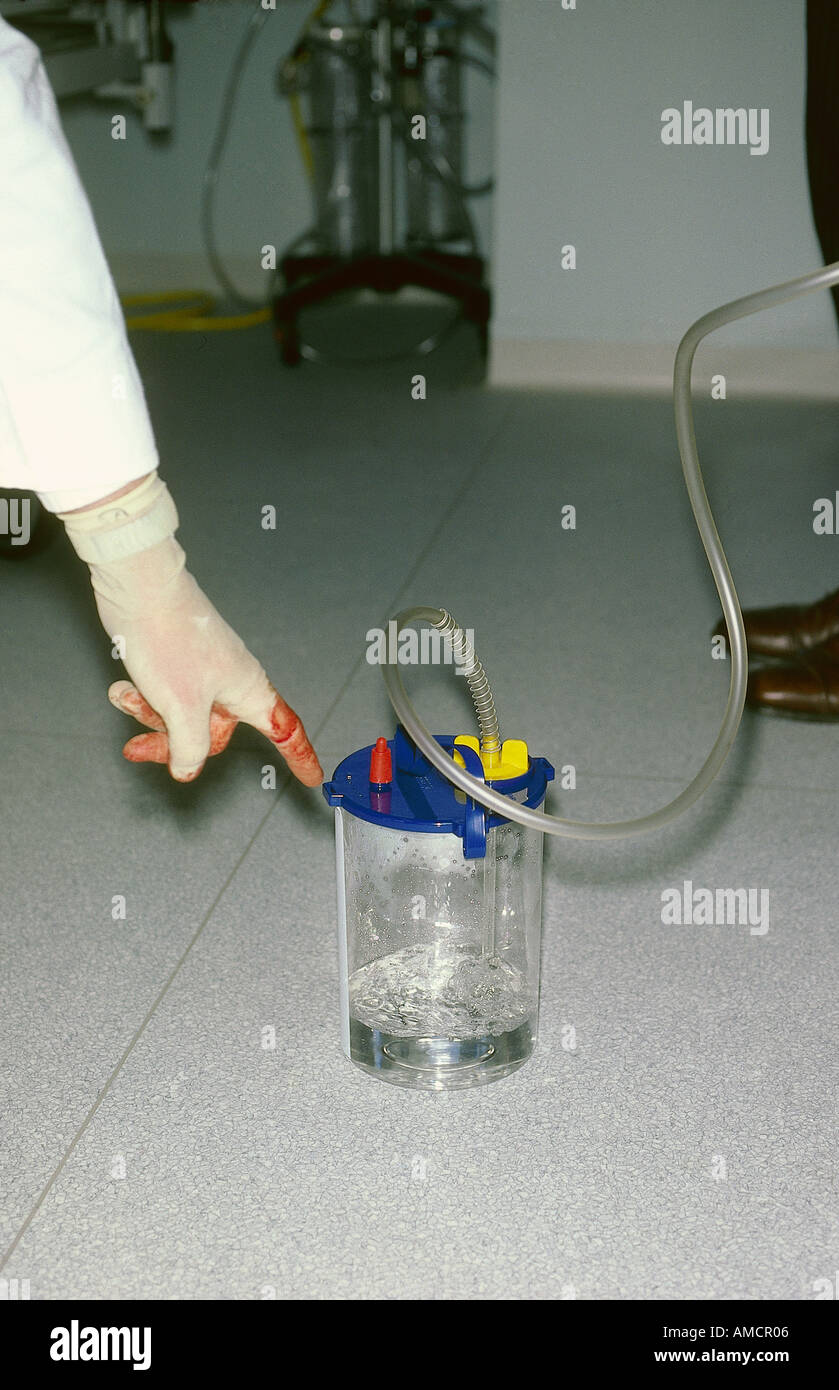 chest tube pneumothorax