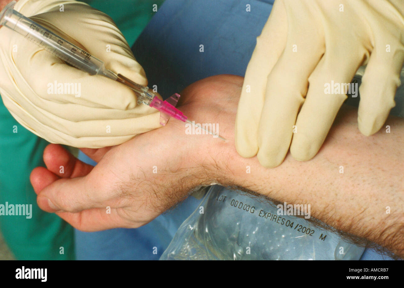 This Is A Photograph Of An Arterial Line Being Inserted In The Radial This Is A Photograph Of An Arterial Line Being Inserted In The Radial