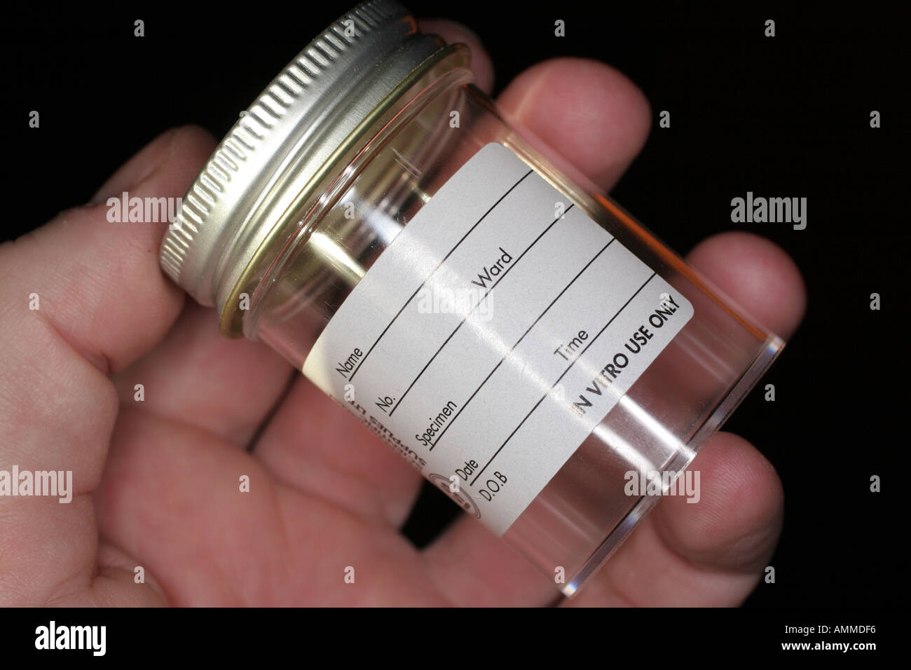 Medical specimen bottle Hospital Urine Stock Photo Alamy