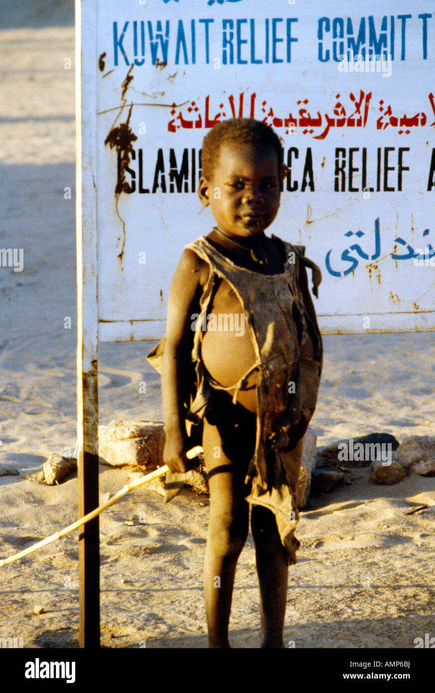 Tandelti Camp Sudan Child Suffering From Marasmus Stock Photo