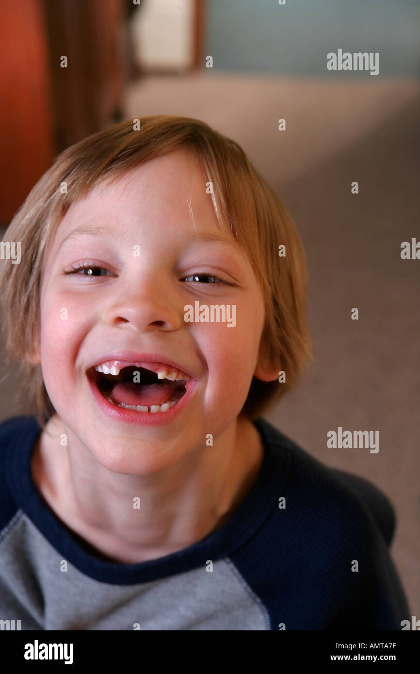 A young boy with his two front teeth missing looks up at the camera and laughs Stock Photo