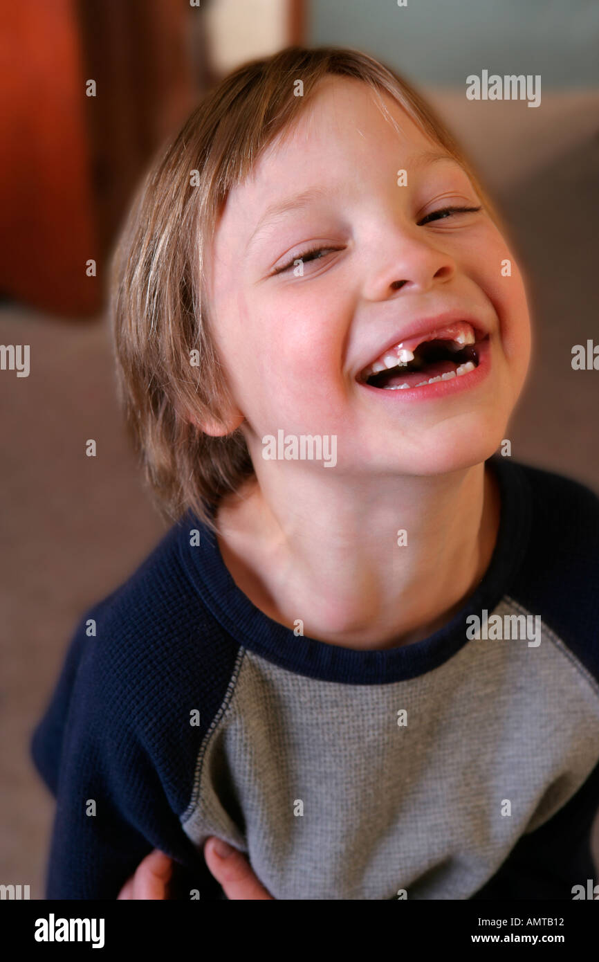 A young boy with his two front teeth missing looks up at the camera and laughs Stock Photo
