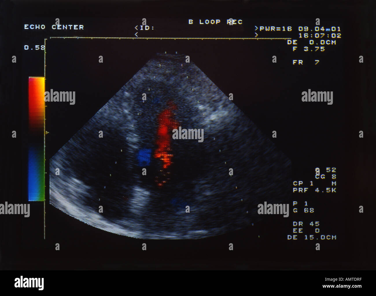 Ultrasound cardiac examination Stock Photo - Alamy