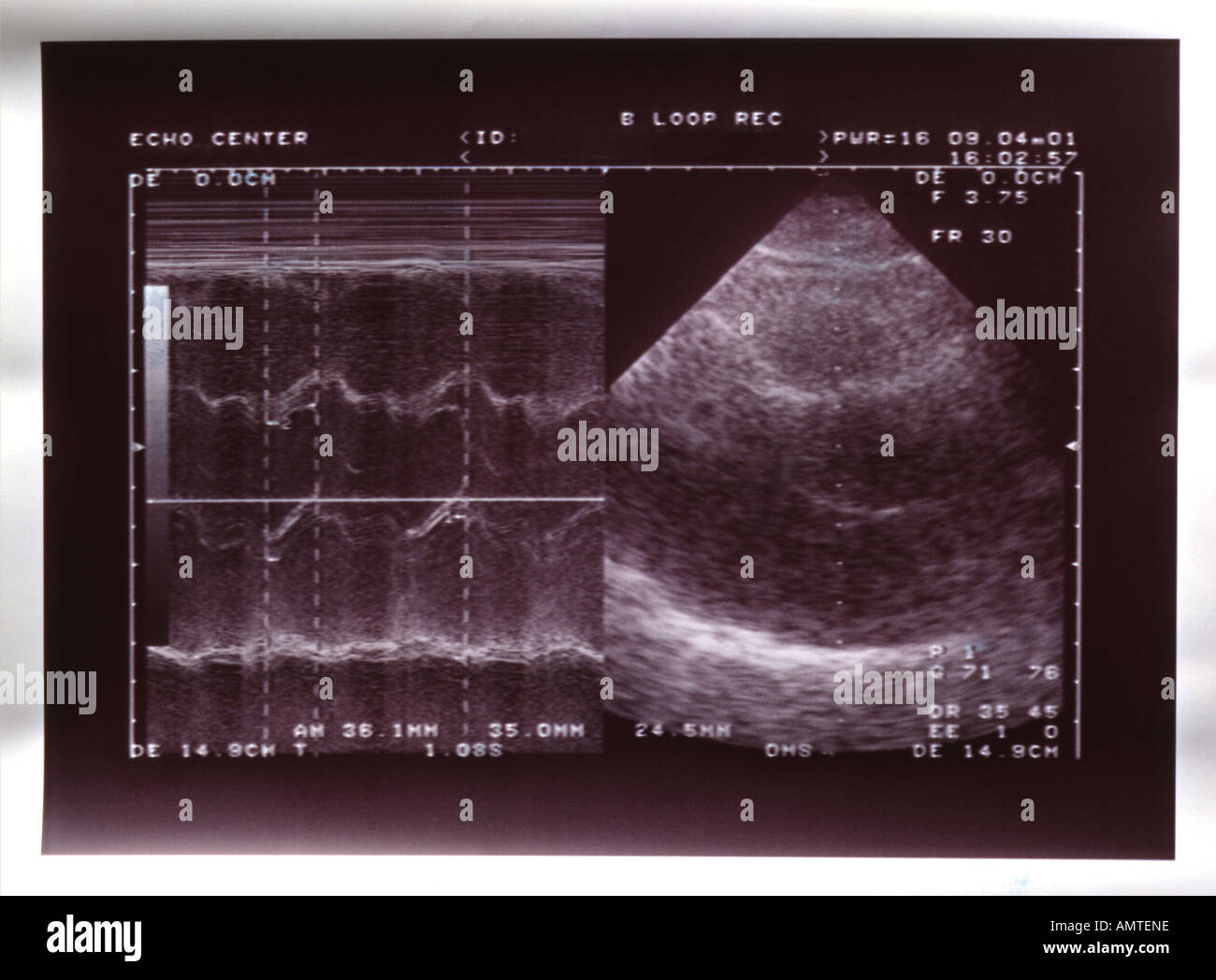 Ultrasound cardiac examination Stock Photo