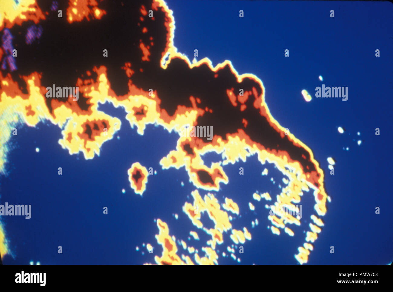 Fetus Head face Stock Photo Alamy