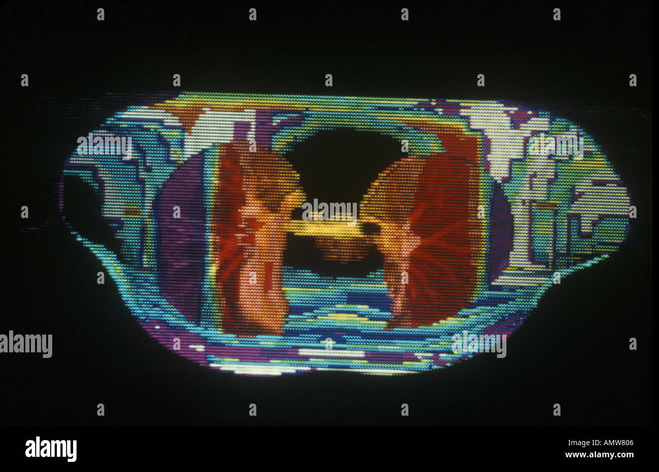 Ct scan lung cancer hi-res stock photography and images - Alamy