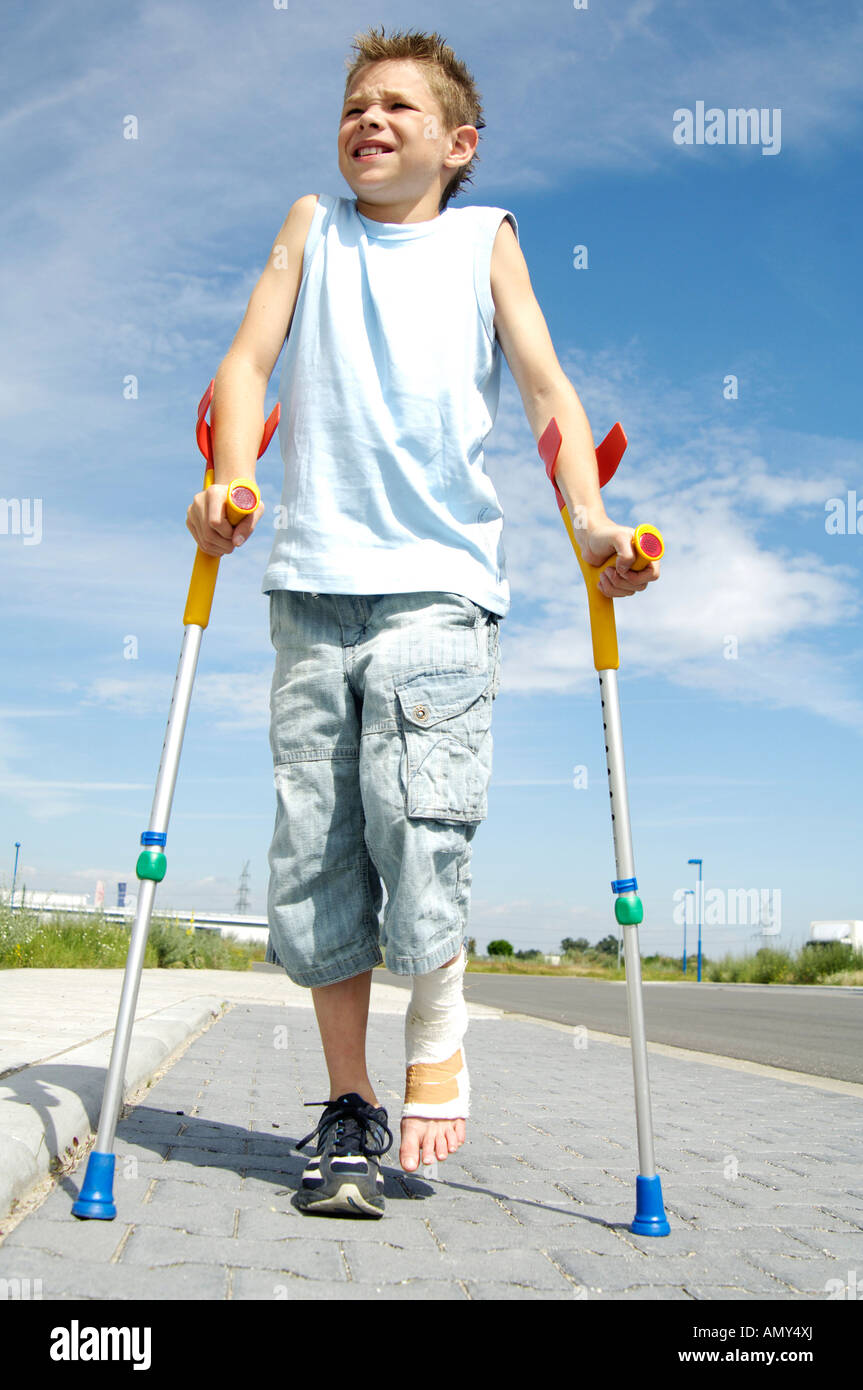 Boy with broken leg Stock Photo Alamy