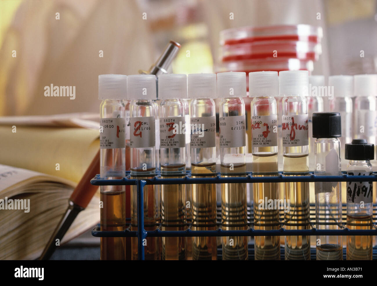 The life of blood plasma samples in a medical Testing Laboratory Stock