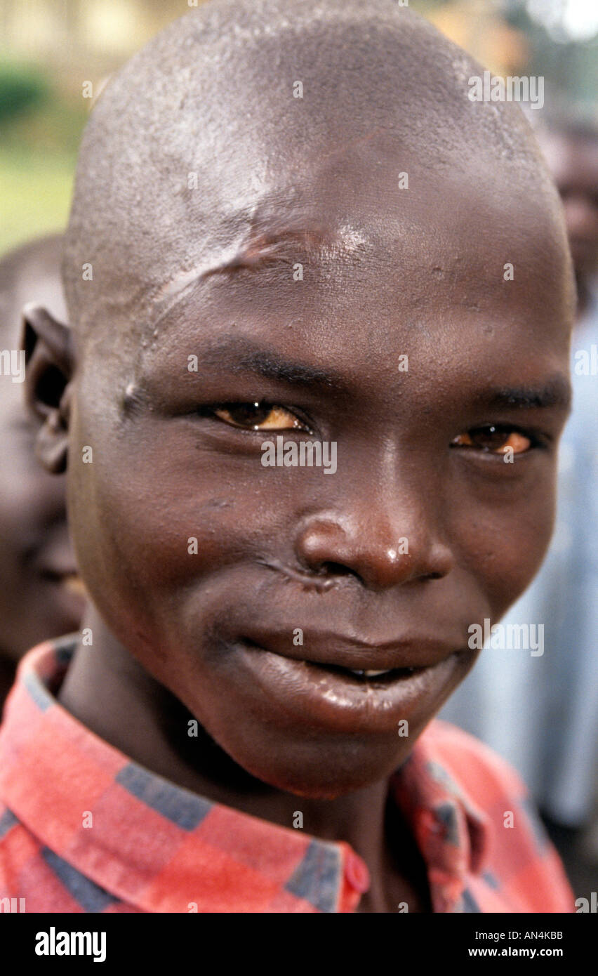 Man showing scars suffered in war, Uganda, Africa Stock Photo