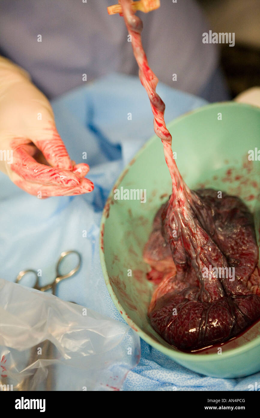 Midwife checking placenta immediately after birth Stock Photo