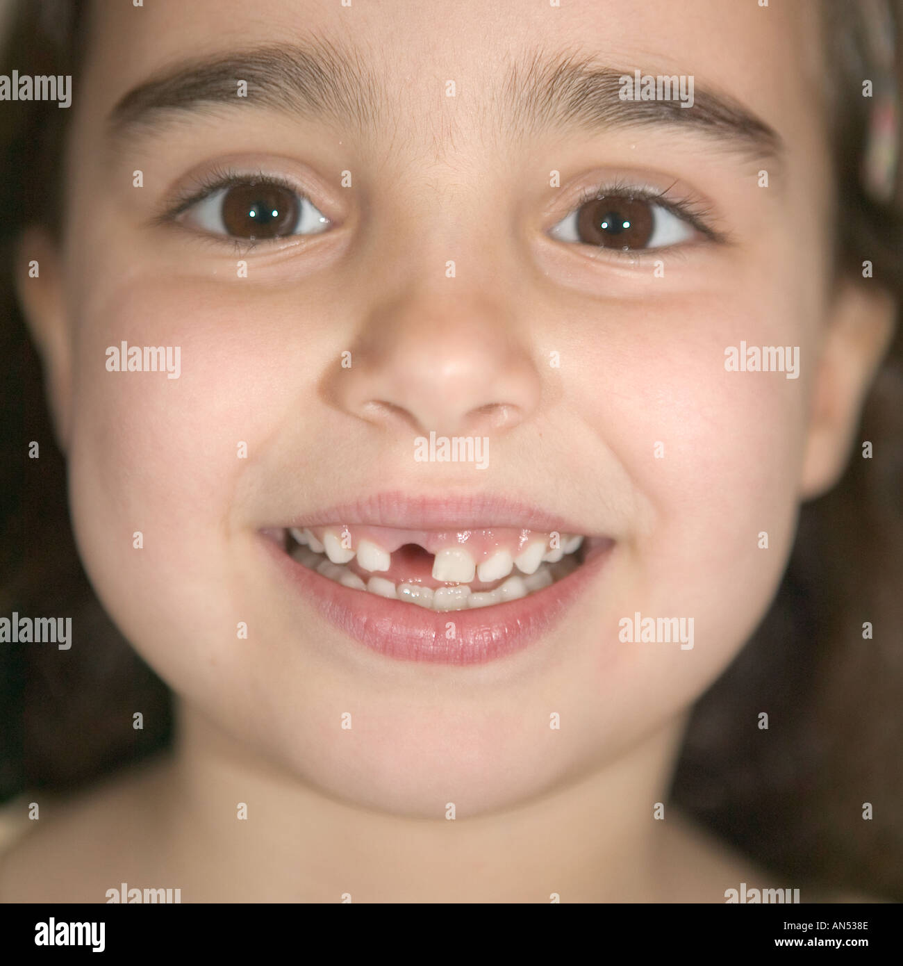 A girl missing a tooth Stock Photo