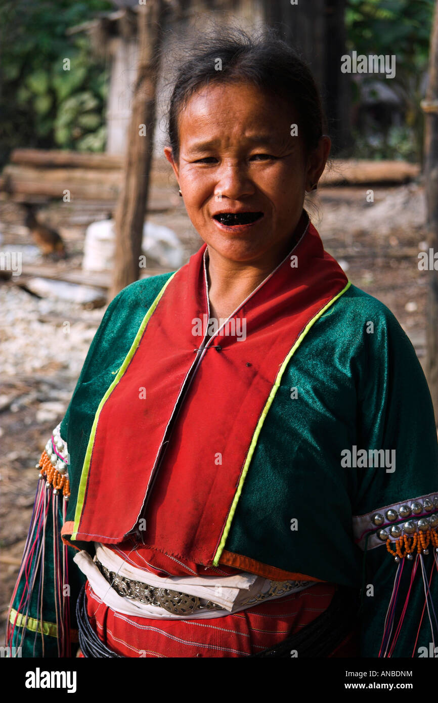 Southeast Asia, Thailand, Panghore, Woman from the Palaung People with Blackened Teeth Stock Photo