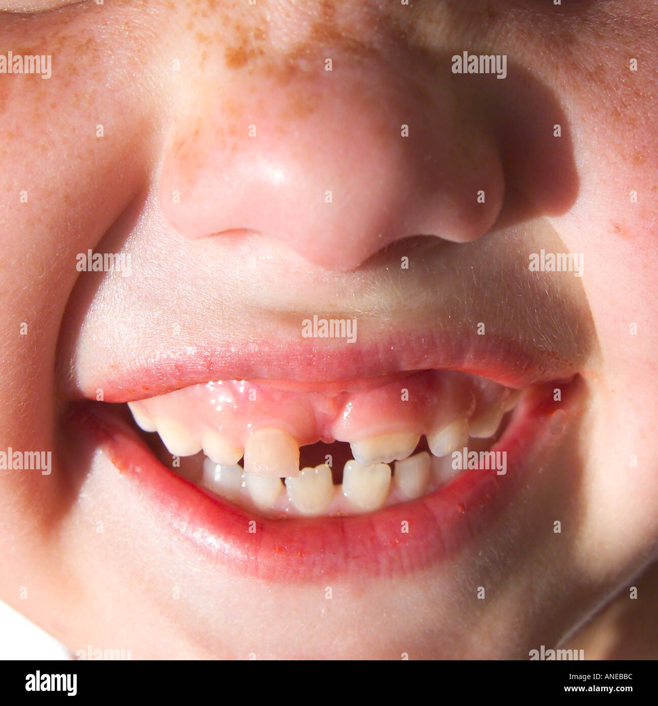 child s teeth with gap Stock Photo Alamy
