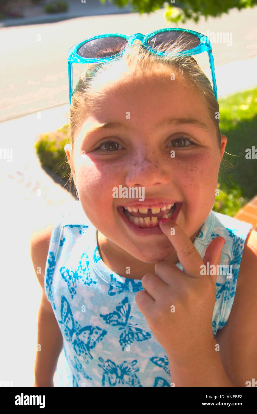 missing tooth Stock Photo