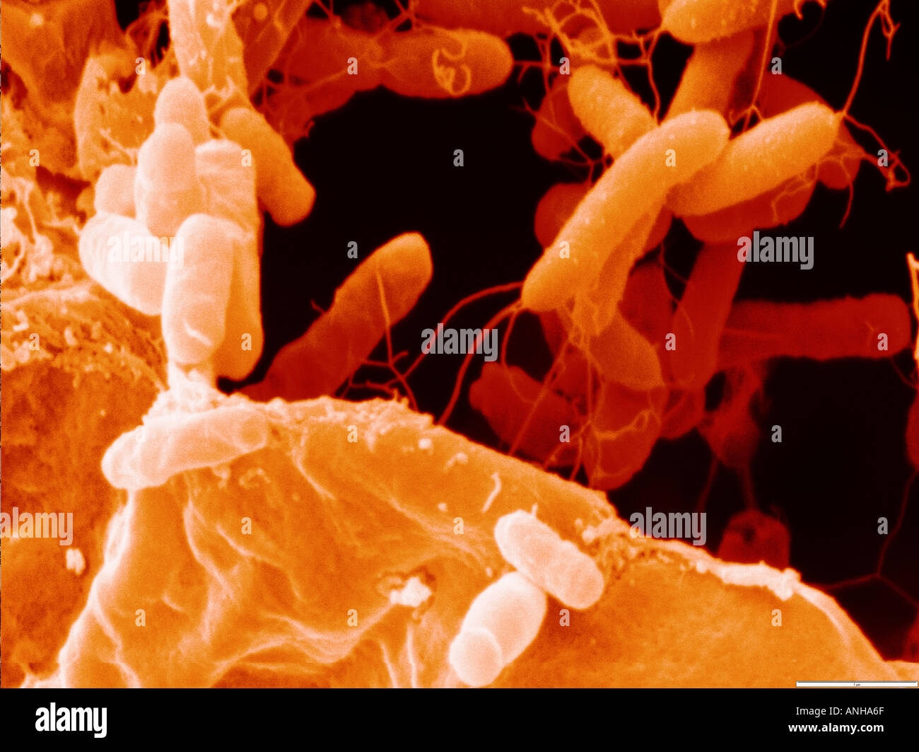 Color enhanced scanning electron micrograph of Agrobacterium Stock ...