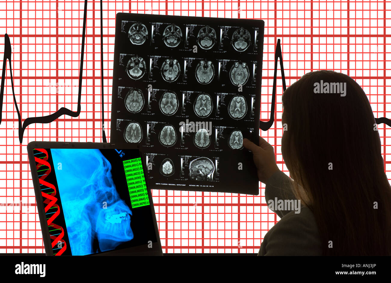 computer operator with MRI medical image on monitor and background Stock Photo