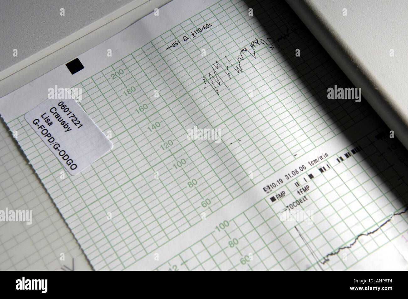 ecg electrocardiograph maternity pregnancy heart rate monitor baby
